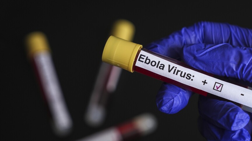 KDC'de 900'den Fazla Şüpheli Ebola Vakası Tespit Edildi